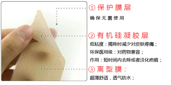 疤痕貼結構示意圖